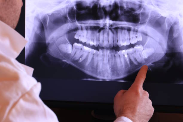 Best Walk-In Emergency Dentist in Galena Park, TX